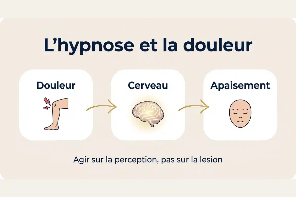 Comment l'hypnose agit sur la douleur Schéma en trois étapes : la douleur passe par le cerveau, l'hypnose apaise la perception